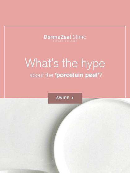 This graphic introduces the hype around the 'porcelain peel,' another name for the Carbon Laser Peel, a popular and effective treatment for achieving a flawless, even-toned complexion.