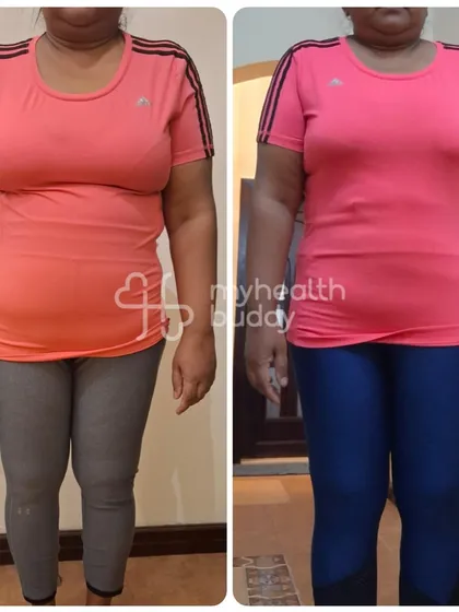This client lost 8 kgs in 6 months, successfully navigating her journey even with knee arthritis. This shows that workouts can be adapted for joint pain.