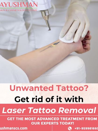 If you have tattoo regret, my laser tattoo removal service can help. I use advanced technology to help you regain your skin's natural canvas, free from unwanted ink.
