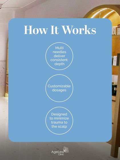 This graphic breaks down how the Multi-Injector technology works. By using multiple fine needles, it delivers customizable dosages at a consistent depth while minimizing trauma to the scalp, making the treatment process for hair regrowth highly effective and comfortable.
