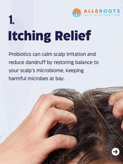 Probiotics can provide significant itching relief for the scalp. By restoring balance to the scalp's microbiome, they help calm irritation and keep the microbes that cause dandruff and itching at bay.