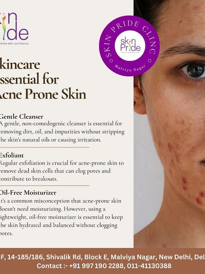 Here are the skincare essentials for acne-prone skin: a gentle cleanser, an exfoliant, and an oil-free moisturizer are crucial for keeping skin balanced.