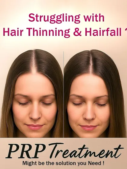 Are you struggling with hair thinning and hair fall? This is one of the most common concerns I hear. PRP treatment is a proven solution that uses your own blood platelets to kickstart natural hair regrowth and give you fuller hair.