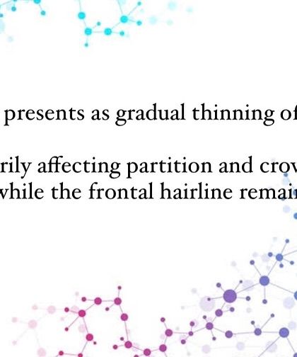 The classic presentation of FPHL is a gradual thinning of hair, most noticeably at the crown and along the hair partition. Unlike male pattern baldness, the frontal hairline typically remains intact.