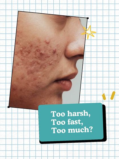 Is your routine too harsh, too fast, or too much? If your skin is reacting or tired, it might be a sign that your approach needs to change from quick fixes to sustainable care.