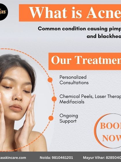 Acne is a common condition causing pimples and blackheads, but the right treatment can make all the difference. We offer personalized consultations, chemical peels, laser therapy, and ongoing support to guide you on your journey to clear skin.