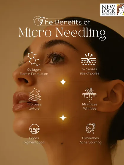 Microneedling is one of our key treatments for improving skin texture and firmness. This infographic highlights its main benefits, from stimulating collagen and elastin production to diminishing acne scarring and reducing pigmentation. It is a powerful tool for achieving smoother, more radiant skin.
