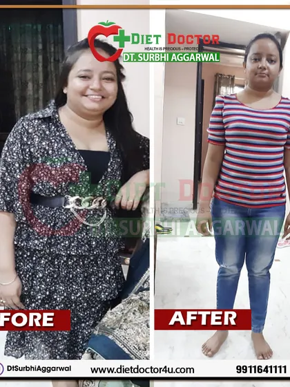 This before and after image shows the powerful transformation of Akansha, a chartered accountant who lost 7 kgs in 3 months. Despite a hectic schedule and health challenges like high blood pressure, she achieved significant weight loss and improved her health markers.