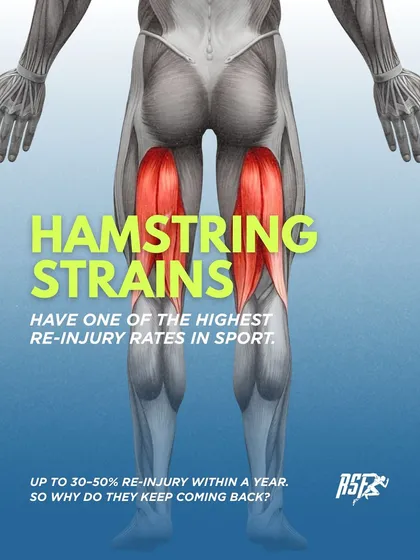 Hamstring strains have one of the highest re-injury rates in sport, with up to 50% of athletes experiencing a recurrence within a year. This happens because conventional rehab often fails to prepare the muscle for the demands of high-speed sport.
