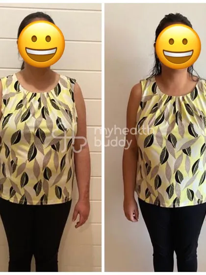 A front view of the same client's 7 kg transformation. She learned that simple changes like walking and portion control can do wonders.