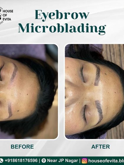 This before-and-after demonstrates how Microblading can add density and structure. The new brows look fuller and more polished.
