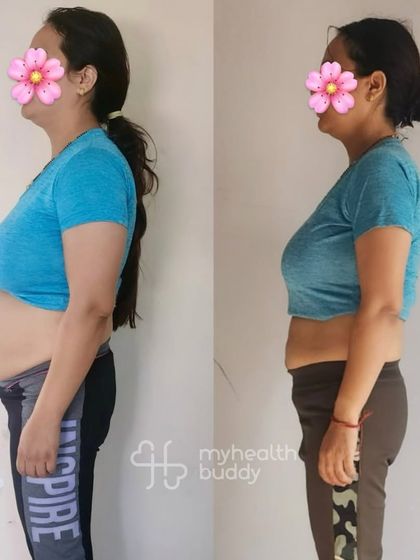 This postpartum mom lost 9 kgs in 6 months. Her journey shows that even with the challenges of a new baby, consistent effort in both nutrition and exercise leads to amazing, sustainable results.