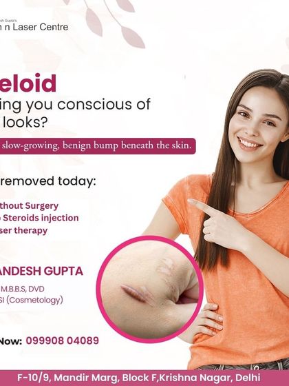 Don't let keloids make you self-conscious. This post explains how our laser therapy can remove these benign bumps without surgery or steroid injections, offering a safe and effective solution.