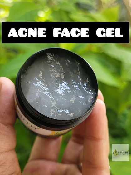 A close-up of my Acne Face Gel, showing its clear, light texture. This gel is designed to be a targeted solution for acne spots, helping to calm inflammation and promote healing.