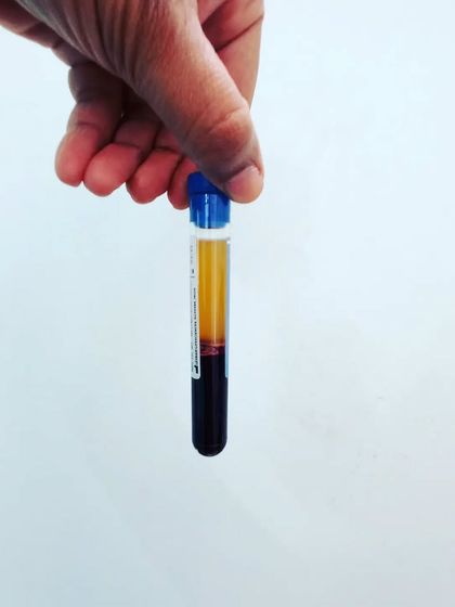 Elegance Skin Clinic - Aesthetic Dermatology Clearing Acne, Scars, and Pigmentation photo 7