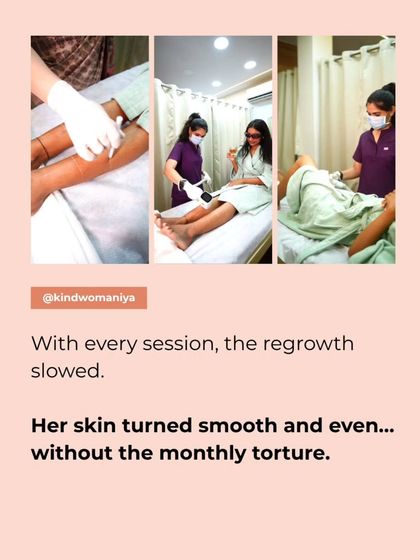 With each laser session, her regrowth slowed, and her skin became smooth and even, all without the monthly torture of waxing. This is the transformation we love to see.