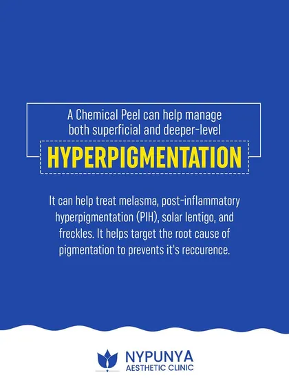 A chemical peel can effectively manage both superficial and deeper levels of hyperpigmentation. It helps treat melasma, post-inflammatory hyperpigmentation (PIH), and freckles by targeting the root cause.