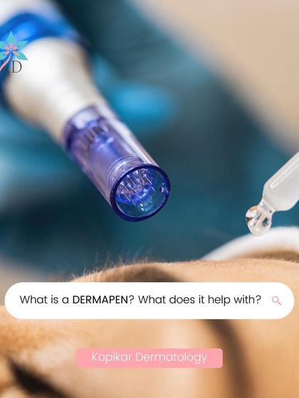 What is a Dermapen? This graphic explains the revolutionary microneedling device that triggers your skin's natural healing process. It's a minimally invasive treatment that tightens skin, reduces acne scars, and improves overall texture.