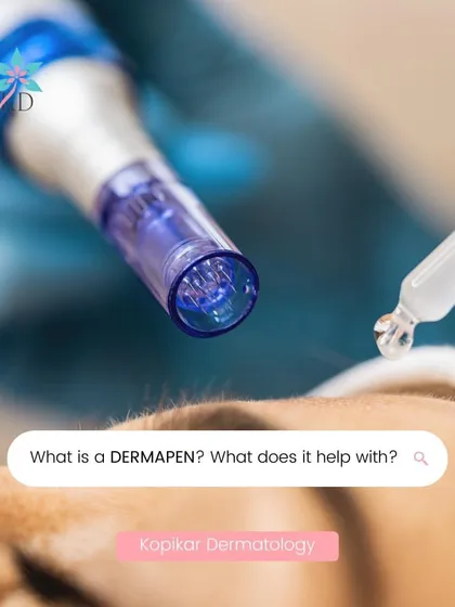 What is a Dermapen? This graphic explains the revolutionary microneedling device that triggers your skin's natural healing process. It's a minimally invasive treatment that tightens skin, reduces acne scars, and improves overall texture.