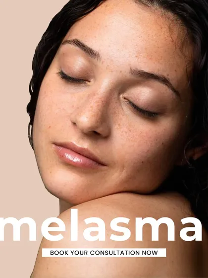 Melasma requires a specialized and patient approach. If you are struggling with these stubborn patches, book a consultation to explore advanced and effective treatment options.
