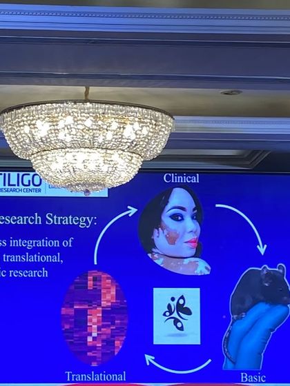 A slide from our VFI conference illustrating our research strategy, which focuses on the seamless integration of clinical, translational, and basic research to find better solutions for Vitiligo.