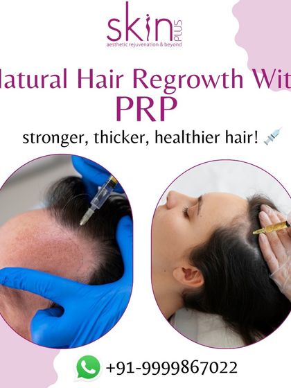 Advanced Non-Surgical Regrowth photo 4