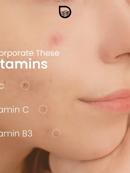 Incorporating certain vitamins and ingredients like Zinc, Vitamin C, and Vitamin B3 (Niacinamide) can support skin healing and help reduce the appearance of scars.