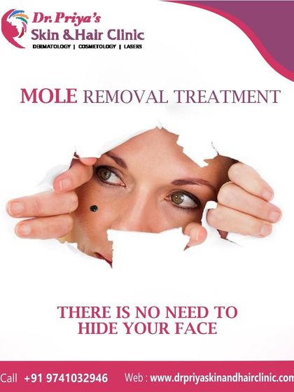 Priya J Talageri - Laser Tattoo & Blemish Removal Blemish, Mole, and Tag Removal photo 4