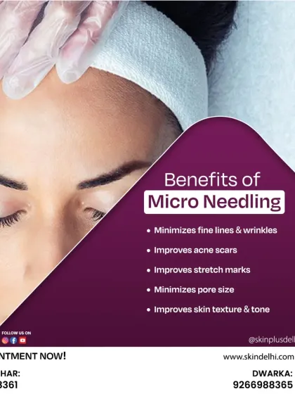 Collagen Boosting: Microneedling & PRP photo 6
