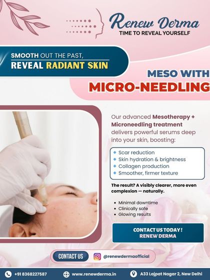 This graphic explains our Meso with Microneedling treatment. This procedure uses fine needles to create micro-channels in the skin, allowing powerful mesotherapy serums to penetrate deeply for enhanced scar reduction, hydration, and collagen production.