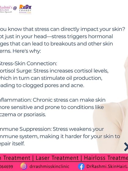 Rashmi's Skin Clinic - Acne & Scar Treatment The Science of Your Skin photo 13