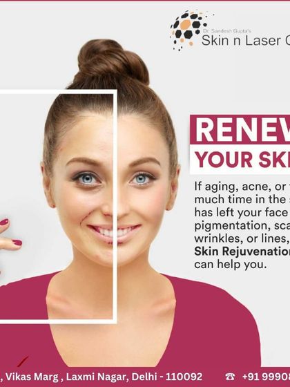 Skin rejuvenation treatments can help if aging, acne, or sun exposure has left your skin with pigmentation, scars, or lines. My clinic offers various options to help you renew your skin and restore its youthful appearance.