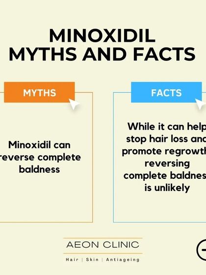 Myth: Minoxidil can reverse complete baldness. Fact: While it can help stop hair loss and promote regrowth in active follicles, it is unlikely to reverse complete baldness where follicles are dormant.