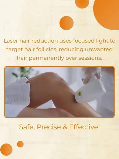 Here you can see our medical-grade laser in action. The process uses a focused beam of light that is absorbed by the pigment in dark, coarse hair. This light energy converts to heat, which damages the hair follicle to inhibit or delay future growth.