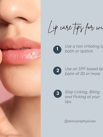 Here are my top three lip care tips for winter: use a non-irritating lip balm, choose one with SPF 30 or more for daytime, and stop licking or picking at your lips.