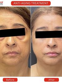 Anti-Aging & Skin Rejuvenation
