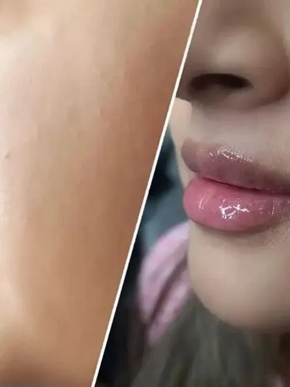 This side-profile view highlights how lip blushing can improve the appearance of lip volume and projection. By adding color and defining the border, the lips naturally look fuller and more pronounced from every angle.