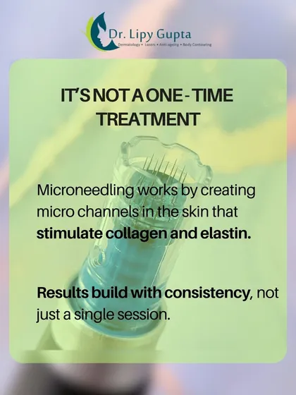 It's important to understand that microneedling is not a one-time fix. Results build with consistency as each session stimulates more collagen and elastin.