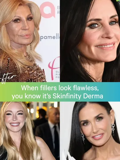Flawless, natural-looking results are the goal. We can correct poorly done fillers and restore facial harmony, as seen in these "after" photos of celebrities who chose a more refined approach.