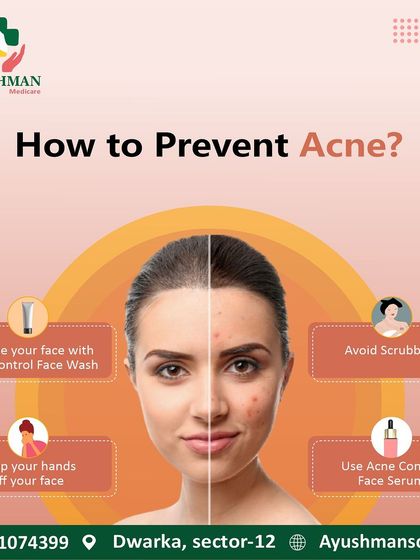 This infographic provides simple, actionable tips on how to prevent acne, including proper cleansing techniques and avoiding scrubbing, to maintain clear skin.