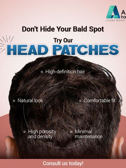 Our head patches are designed with high-definition hair for a natural look and comfortable fit. They feature high porosity and density for a realistic appearance with minimal maintenance.