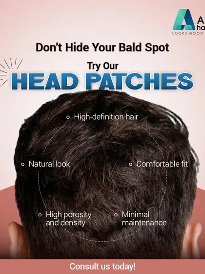 Our head patches are designed with high-definition hair for a natural look and comfortable fit. They feature high porosity and density for a realistic appearance with minimal maintenance.
