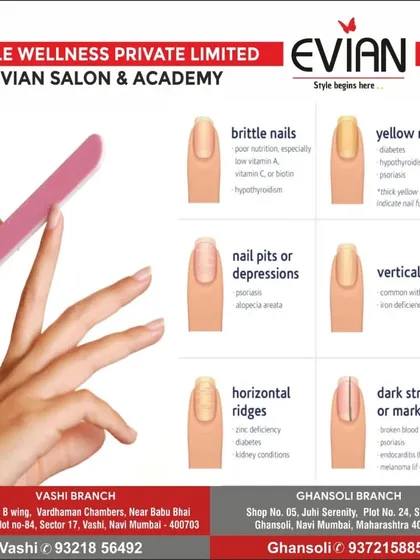 If you are facing issues like brittle, yellow, or ridged nails, I can help. During our consultation, I assess your nail condition to understand the cause and suggest the right care routine.