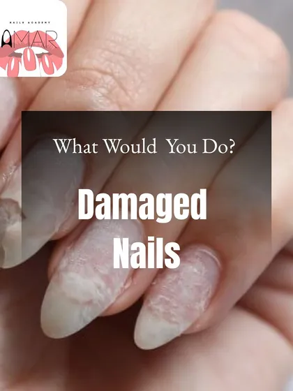 When faced with damaged nails, a professional nail tech must prioritize the client's nail health above all else.