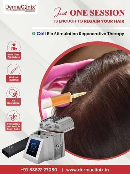 This infographic highlights the key benefits of GCell Bio Stimulation: it's a one-time procedure, minimally invasive, has no downtime, and stimulates hair follicle stem cells.