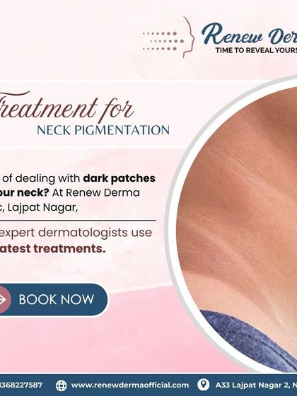 Don't let dark patches on your neck affect your confidence. We use the latest treatments to effectively address neck pigmentation, helping you achieve an even and clear skin tone.