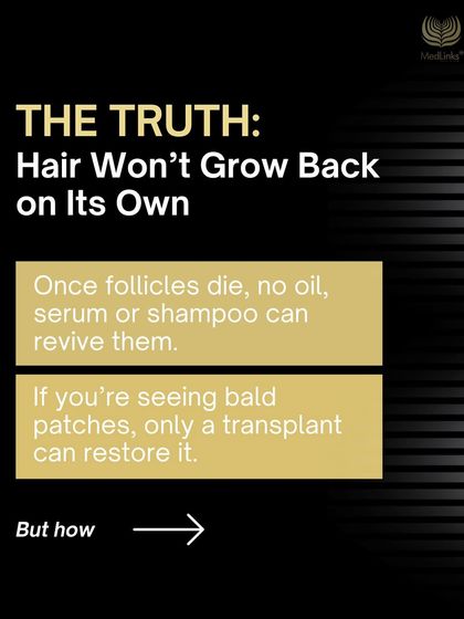The truth is that hair will not grow back on its own once the follicles have died. No oil, serum, or shampoo can revive them. If you are seeing bald patches, only a transplant can restore hair to that area.