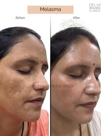 Skin Correction & Rejuvenation