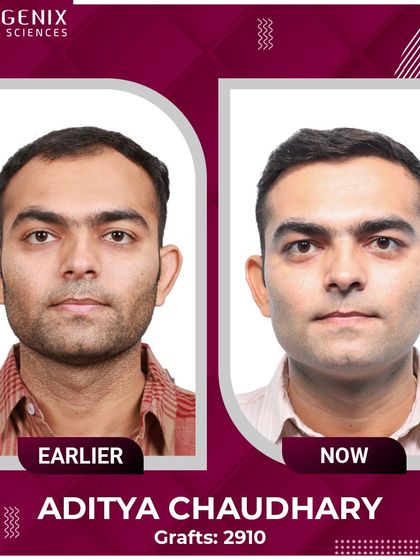 Sub-inspector Aditya Chaudhary explains how his undetectable transplant restored the confidence he needs in his line of duty.