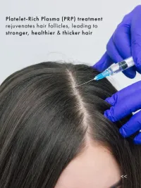 Hair Restoration & Scalp Health